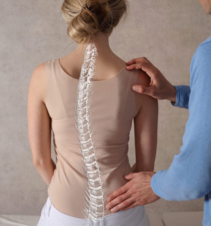 Scoliosis Spine Curve Anatomy, Posture Correction. Chiropractic treatment, Back pain relief.