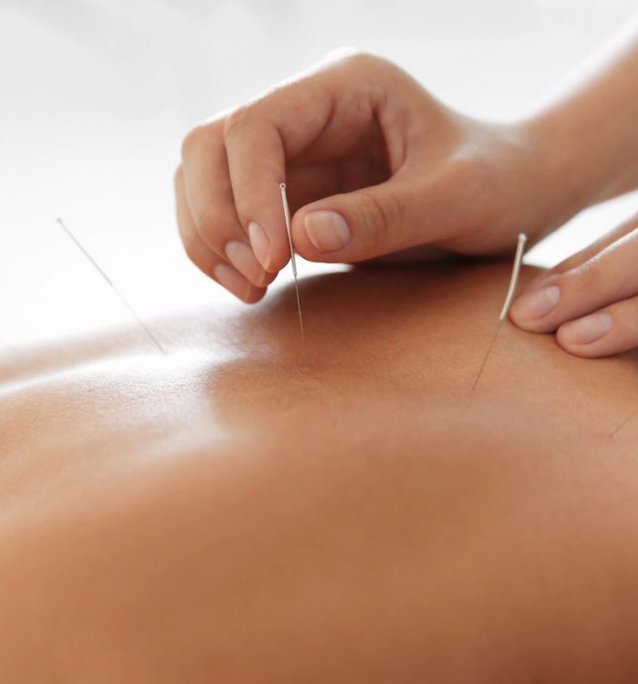 how-to-know-if-your-acupuncture-treatment-is-really-working-img